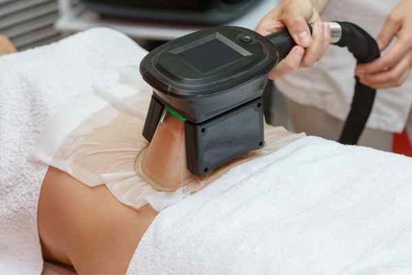 Areas of the Body we treat Cryolipolysis Cambridgeshire
