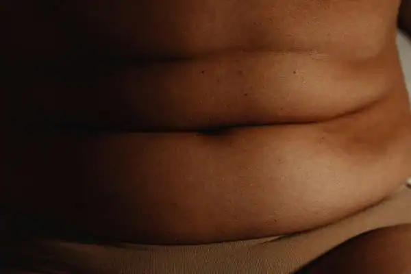 The Hidden Connection: How Stress Shapes Your Fitness and Body Composition 3 image of what stress can do on the stomach area and how Lipo 360 Cambridgeshire can help to change your body shape.